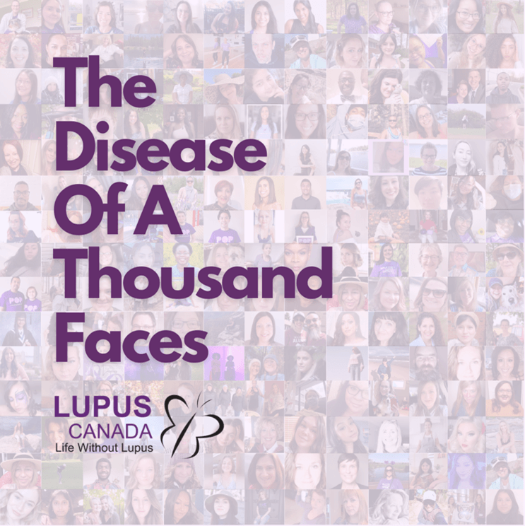 The Disease Of A Thousand Faces Lupus Canada