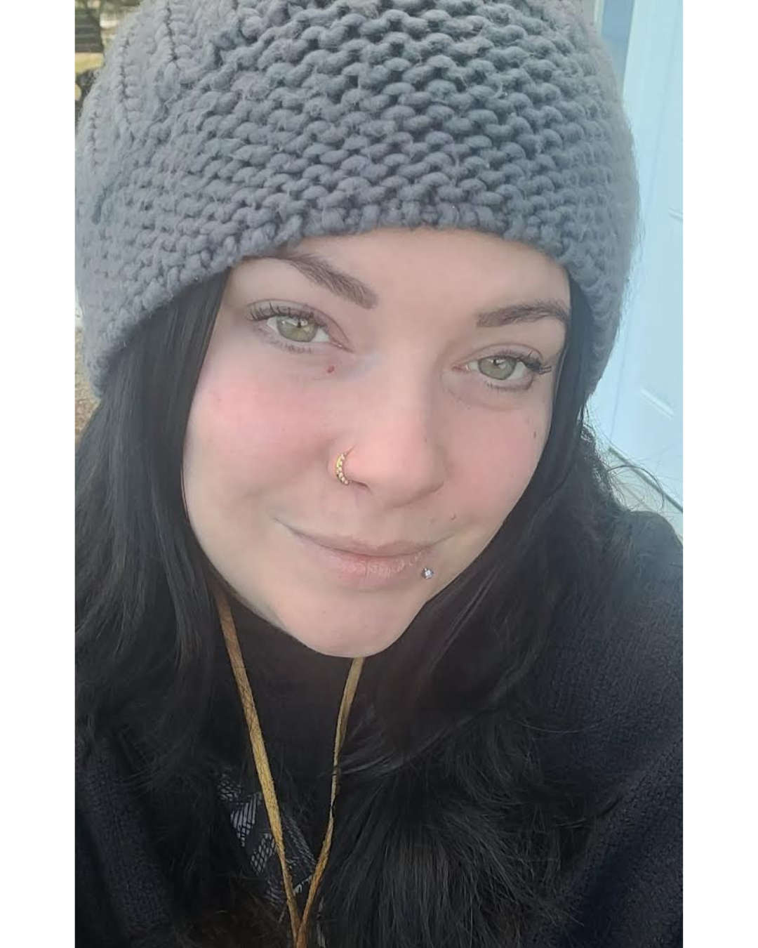 Natasha partage son parcours de lupus et de santé mentale