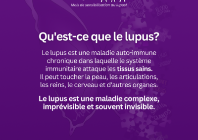 Graphique du Mois de la sensibilisation au lupus violet expliquant ce qu’est le lupus en tant que maladie auto-immune chronique qui affecte plusieurs organes et est souvent invisible