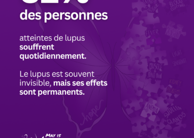 Graphique violet indiquant que 52 % des personnes vivant avec le lupus ressentent des douleurs quotidiennes, soulignant l’impact invisible de la maladie