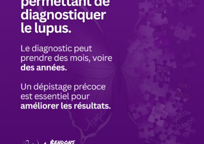 Graphique violet expliquant qu’il n’existe pas de test unique pour le lupus et que le diagnostic peut prendre des mois, voire des années.