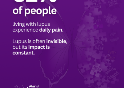 Purple graphic stating that 52 percent of people living with lupus experience daily pain, emphasizing the invisible impact of the disease