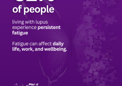 Purple graphic showing that 61 percent of people living with lupus experience persistent fatigue that affects daily life and wellbeing