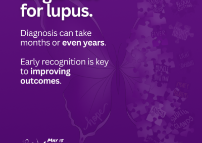 Purple graphic explaining that there is no single test for lupus and that diagnosis can take months or even years