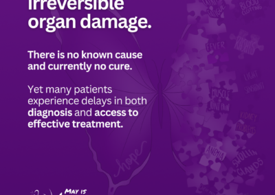 Purple graphic stating that lupus can lead to long term irreversible organ damage and has no known cure