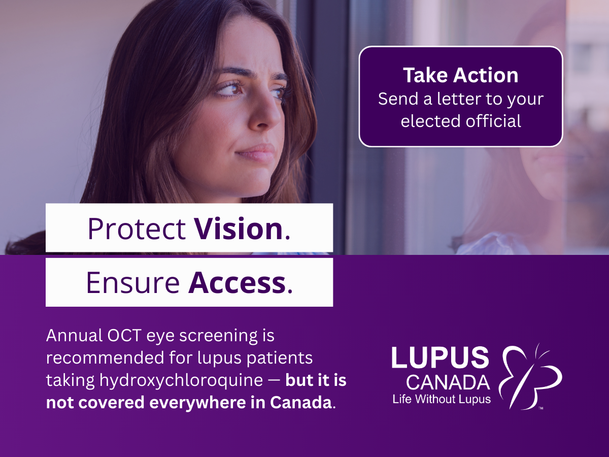 A woman looking out a window with text promoting OCT eye screening access for lupus patients and a call to send a letter to an elected official