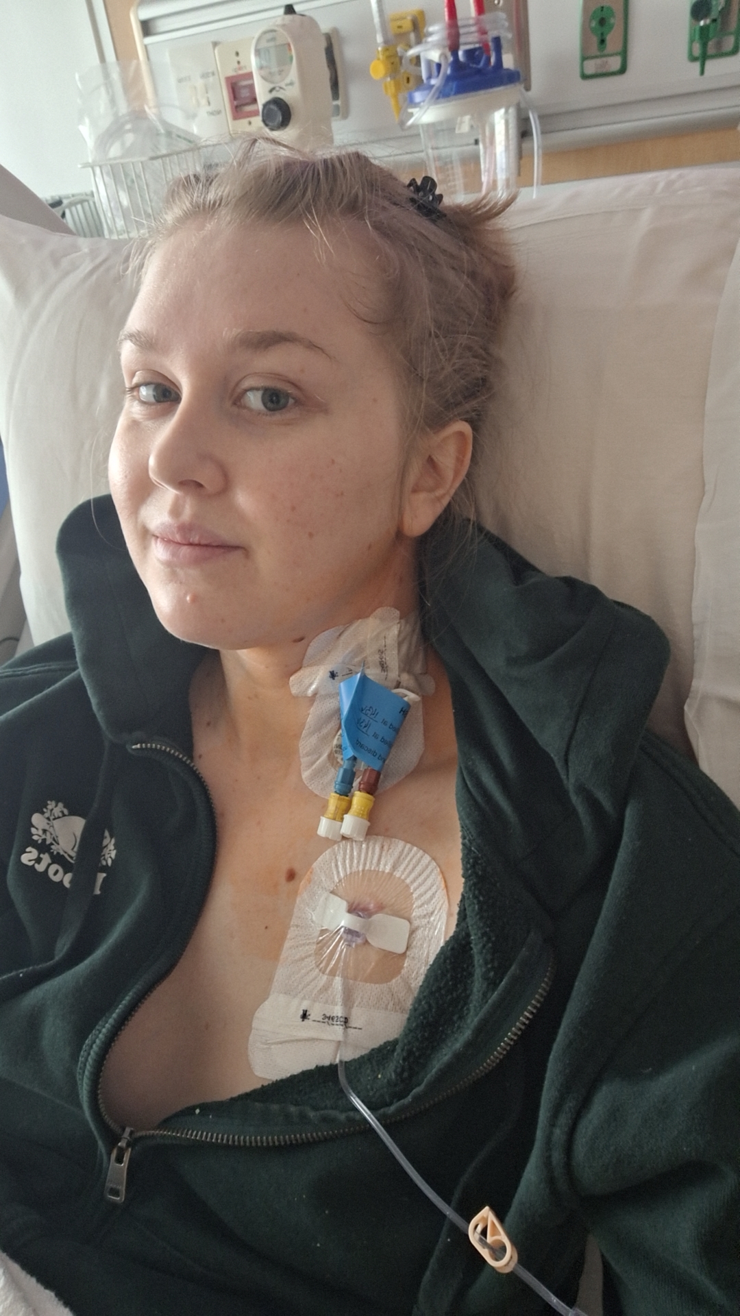 Micah T en traitement par aphérèse pour le lupus