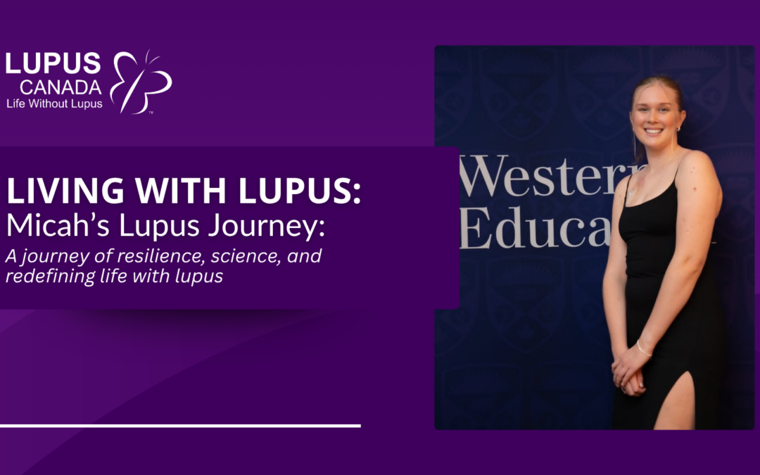 Living with Lupus: Micah’s Story
