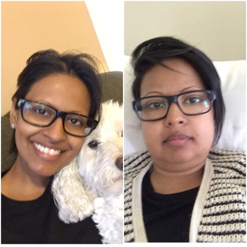 Side by side images of Gabrielle showing her experience living with lupus, one smiling with her dog and one during a period of illness