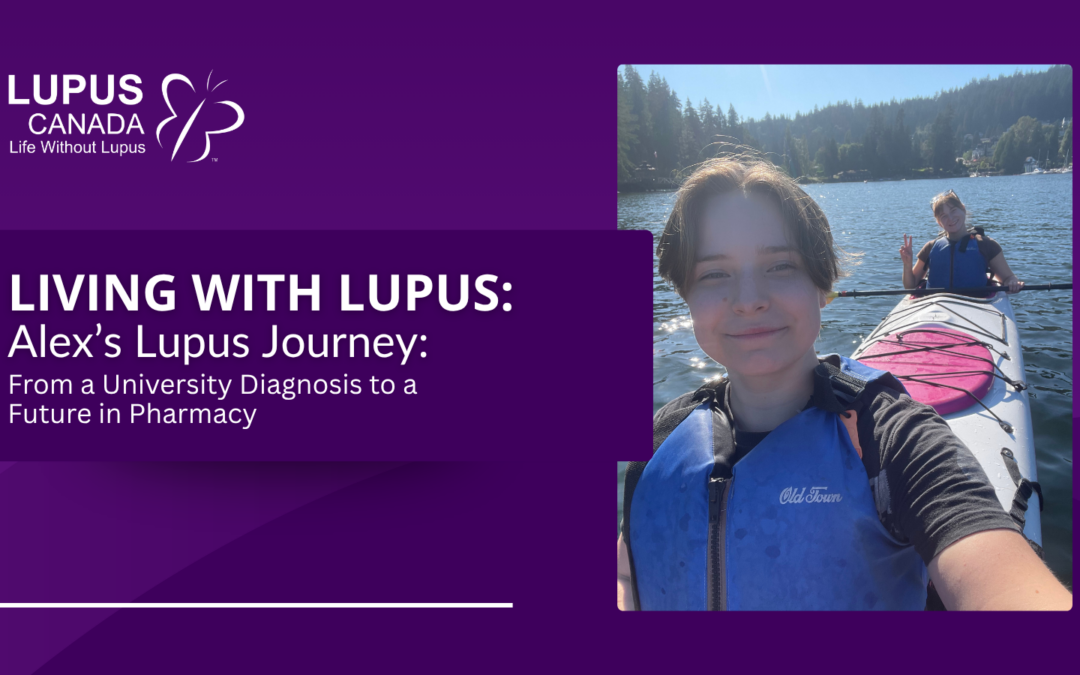 Living with Lupus: Alex’s Story