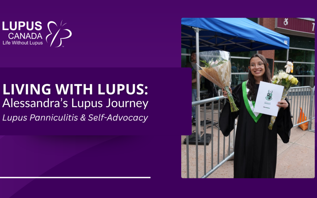 Living with Lupus: Alessandra’s Story | Lupus Panniculitis & Self-Advocacy